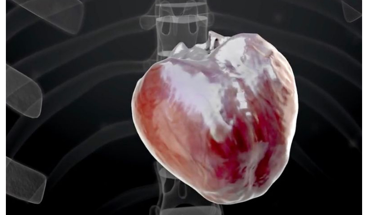 World’s 1st completely robotic heart slated for transplant by 2028